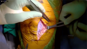 Partial_Knee_9-min